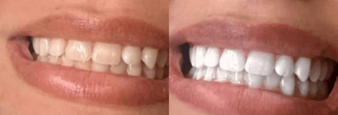 BrowQueen Microblading & Permanent Makeup